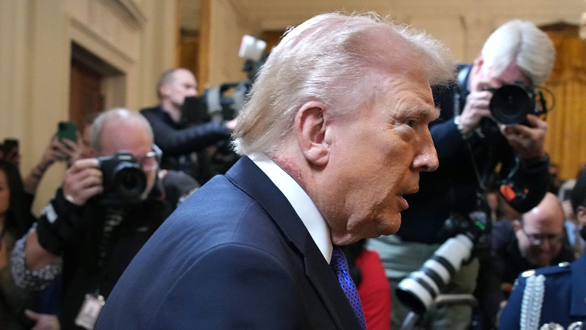 White House doctor explains Trump’s visible neck rash  at george magazine